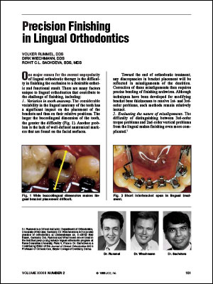 1999 02 RummelV Et Al Precision Finishing In Lingual Orthodontics